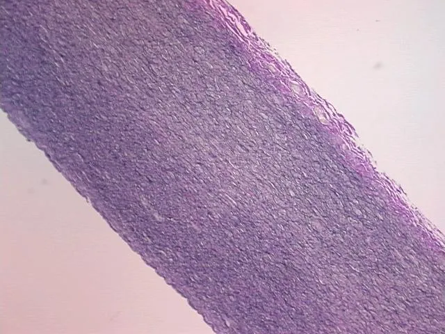 Tissue FFPE Sections, Aorta - image 1