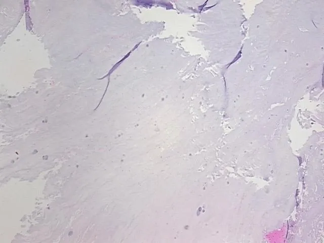 Tissue FFPE Sections, Intervertebral disc - image 1
