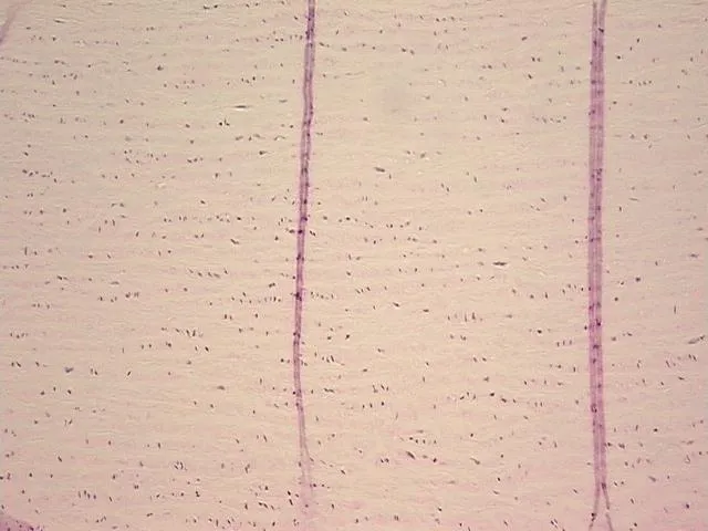 Tissue FFPE Sections, Aorta - image 1