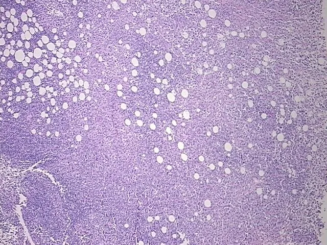 Tissue FFPE Sections, Lymphoid tissue - image 1