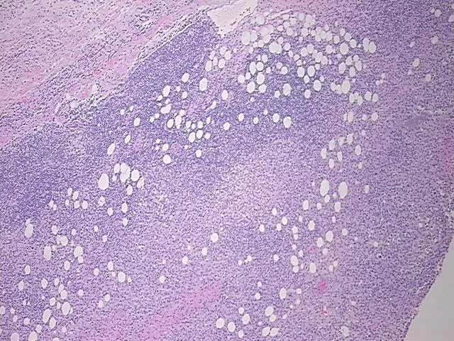 Tissue FFPE Sections, Lymphoid tissue - image 1