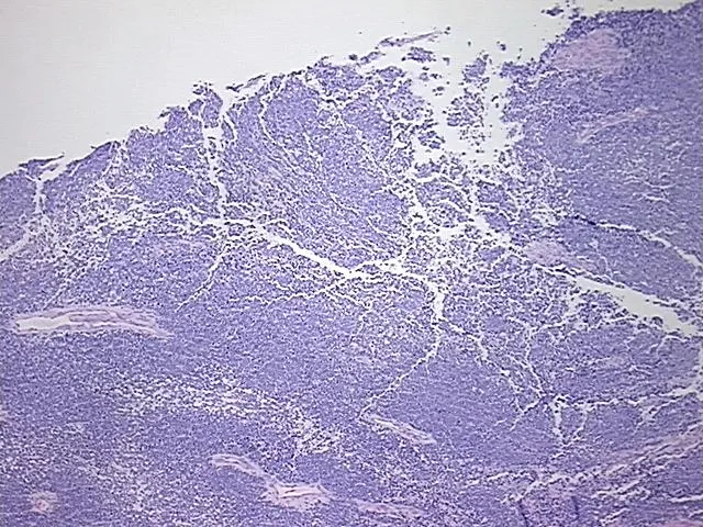 Tissue FFPE Sections, Soft tissue - image 1
