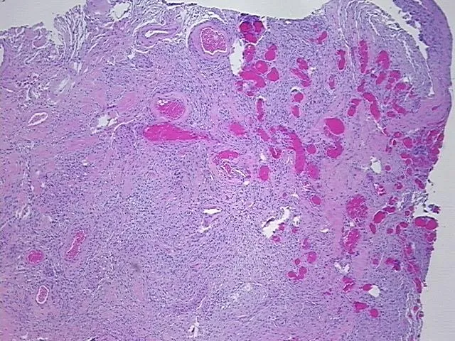 Tissue FFPE Sections, Brain - image 1