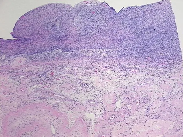 Tissue FFPE Sections, Ovary - image 1