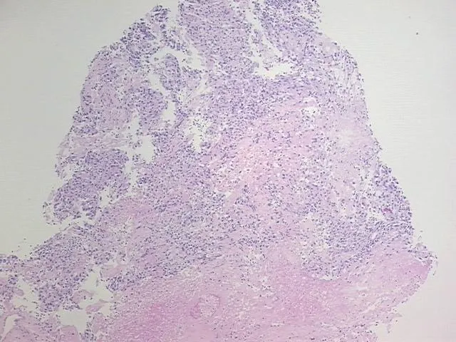 Tissue FFPE Sections, Kidney - image 1