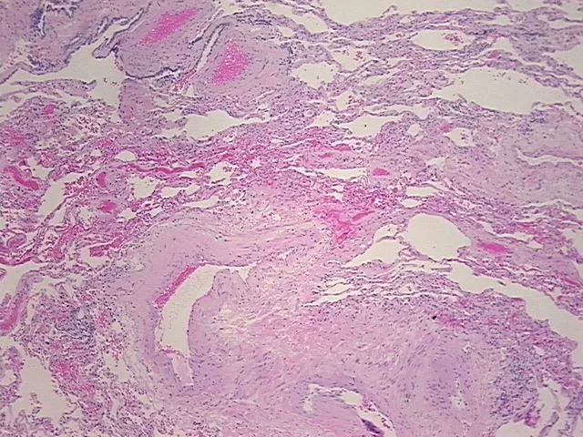 Tissue FFPE Sections, Lung - image 1