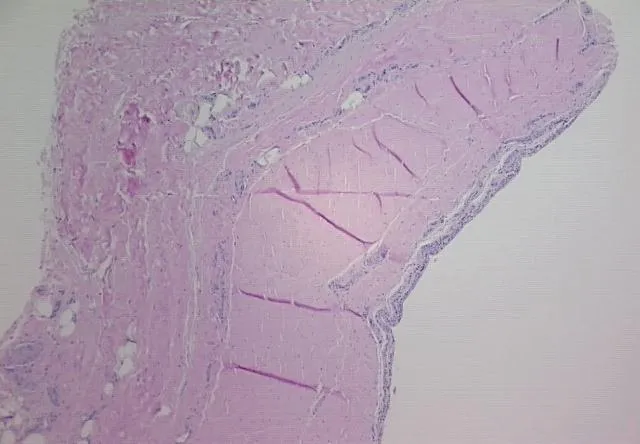 Tissue FFPE Sections, Joint - image 1