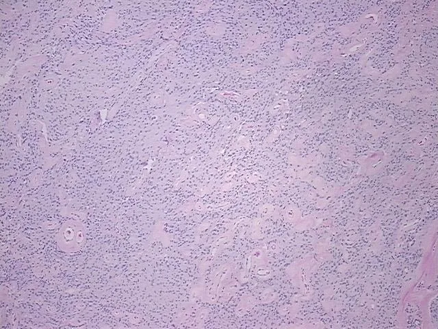 Tissue FFPE Sections, Brain - image 1
