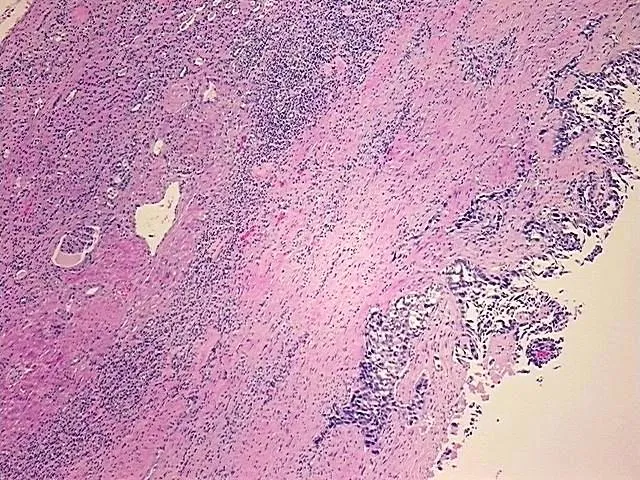 Tissue FFPE Sections, Multiple urinary system sites - image 1