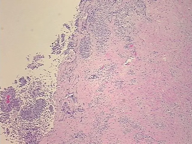 Tissue FFPE Sections, Multiple urinary system sites - image 1