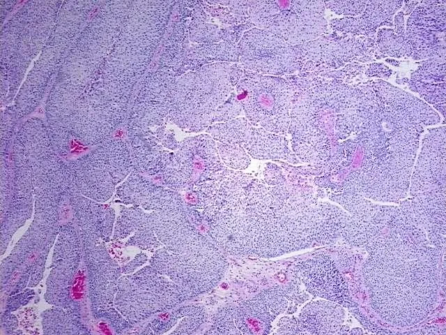Tissue FFPE Sections, Multiple urinary system sites - image 1