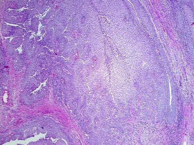 Tissue FFPE Sections, Multiple urinary system sites - image 1