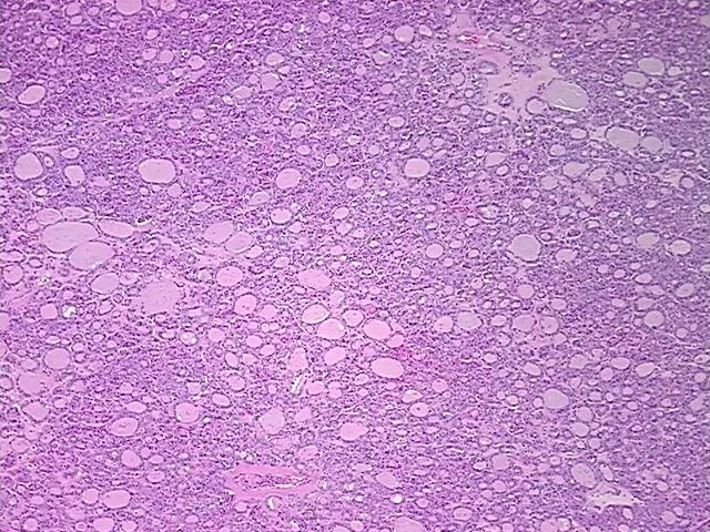 Tissue FFPE Sections, Thyroid gland - image 1