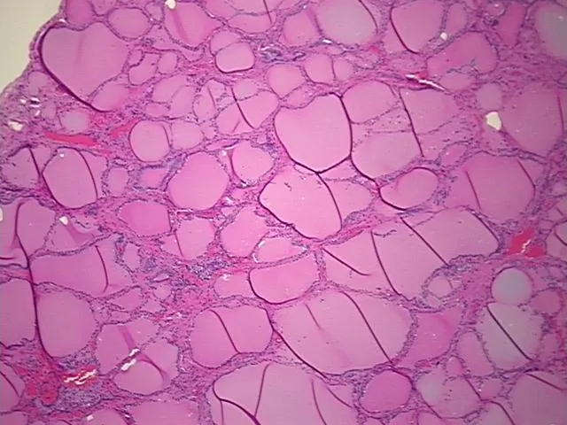 Tissue FFPE Sections, Thyroid gland - image 1