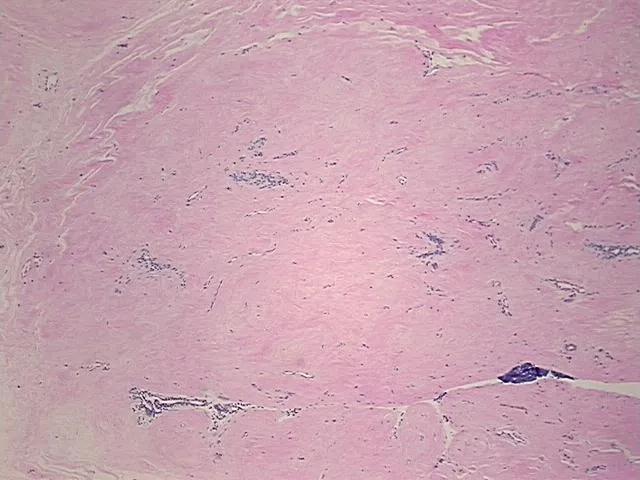 Tissue FFPE Sections, Breast - image 1
