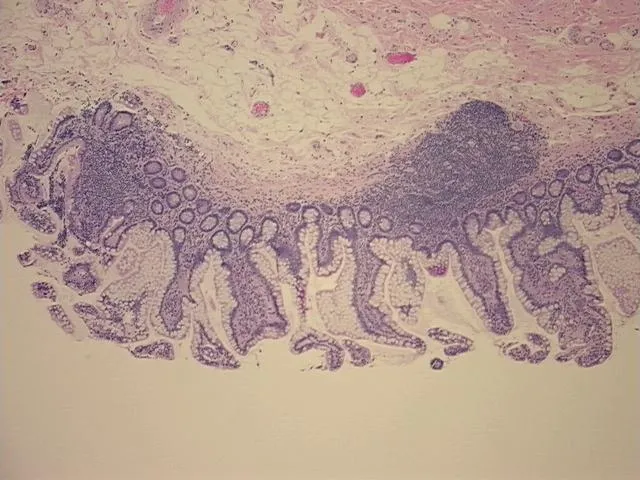Tissue FFPE Sections, Small intestine - image 1