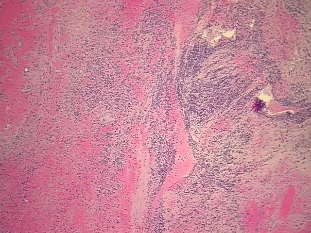Tissue FFPE Sections, Kidney - image 1