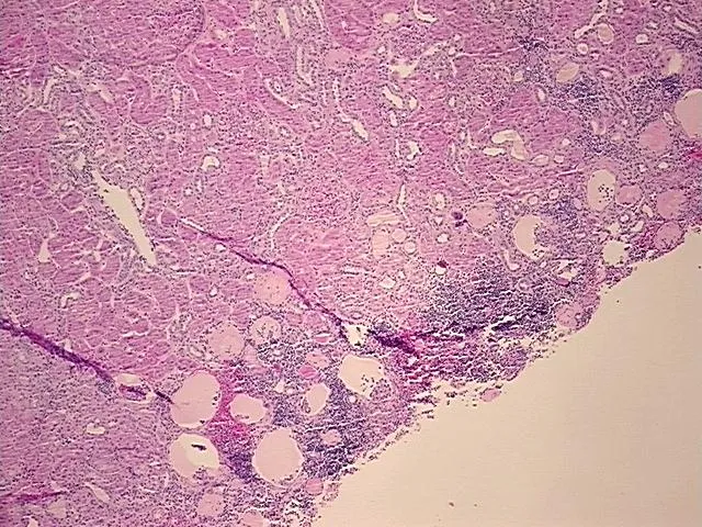 Tissue FFPE Sections, Kidney - image 1