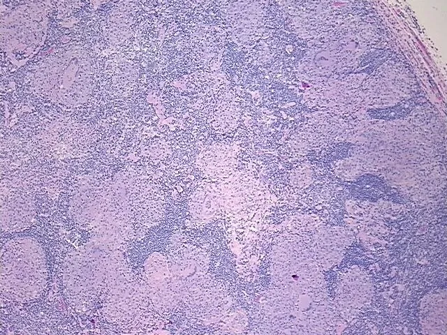 Tissue FFPE Sections, Lymph node - image 1