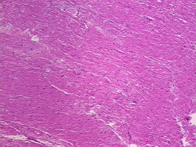 Tissue FFPE Sections, Heart - image 1
