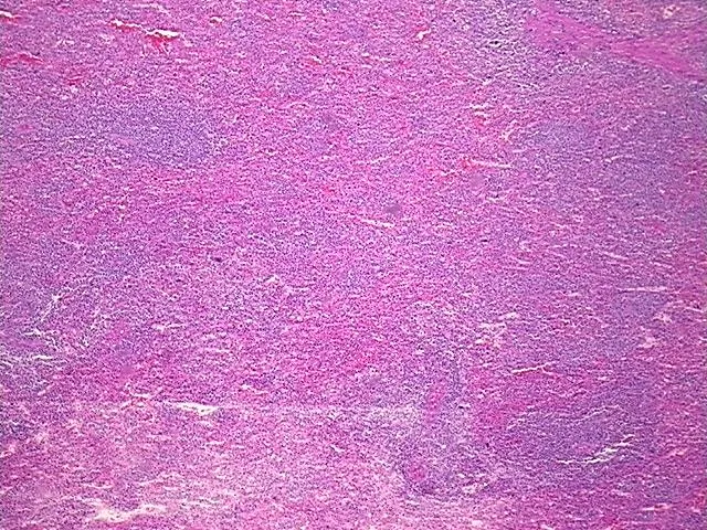 Tissue FFPE Sections, Lymphoid tissue - image 1