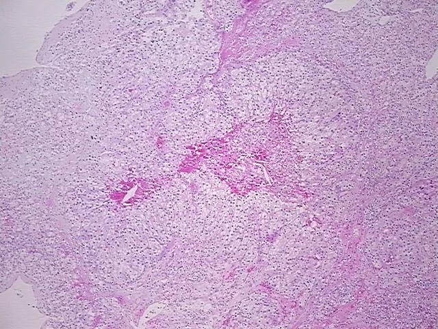 Tissue FFPE Sections, Kidney - image 1