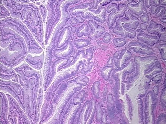 Tissue FFPE Sections, Colon: right - image 1