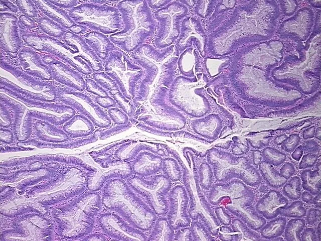 Tissue FFPE Sections, Colon: right - image 1