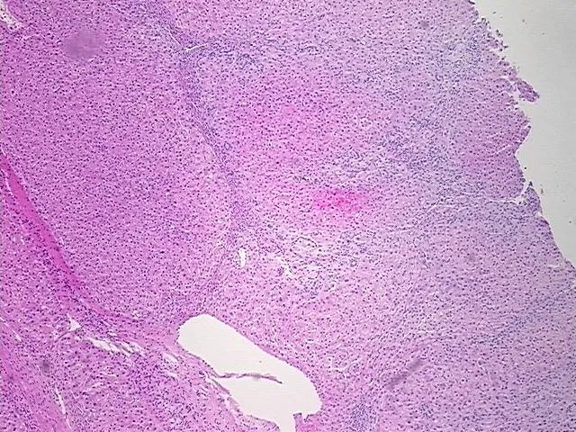 Tissue FFPE Sections, Liver - image 1