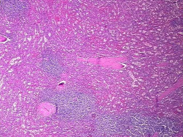 Tissue FFPE Sections, Spleen - image 1
