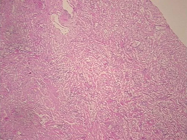 Tissue FFPE Sections, Kidney - image 1
