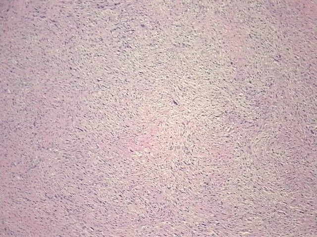 Tissue FFPE Sections, Soft tissue - image 1