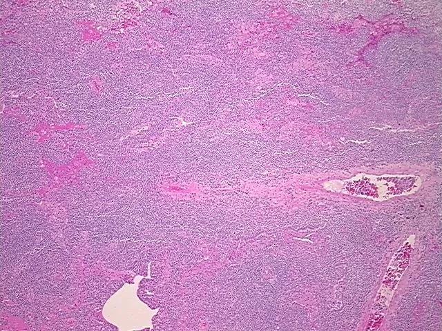 Tissue FFPE Sections, Lymphoid tissue - image 1