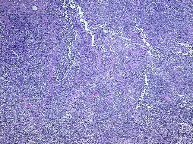 Tissue FFPE Sections, Lymphoid tissue - image 1