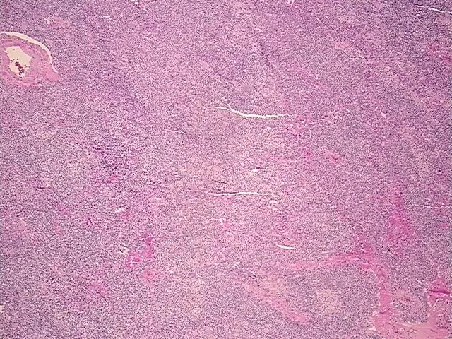 Tissue FFPE Sections, Lymphoid tissue - image 1