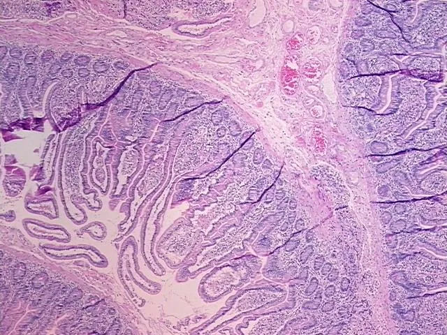 Tissue FFPE Sections, Jejunum - image 1