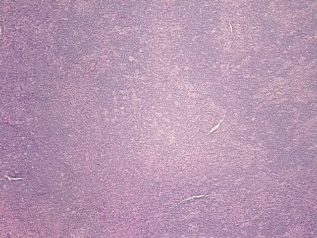 Tissue FFPE Sections, Lymphoid tissue - image 1