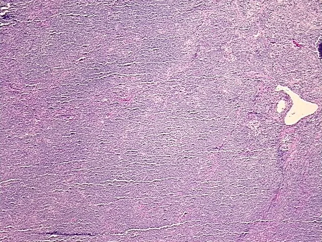 Tissue FFPE Sections, Lymphoid tissue - image 1
