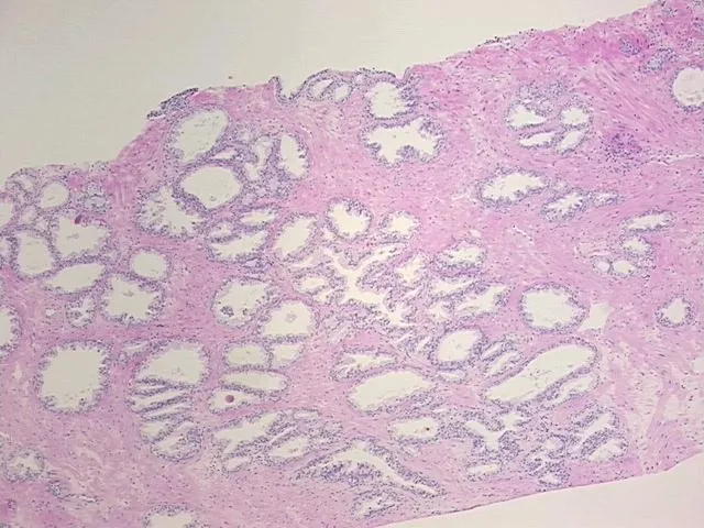 Tissue FFPE Sections, Prostate - image 1
