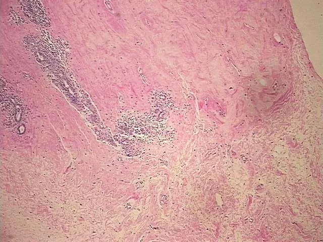 Tissue FFPE Sections, Breast - image 1