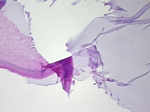 Tissue FFPE Sections, Cervix - image 1