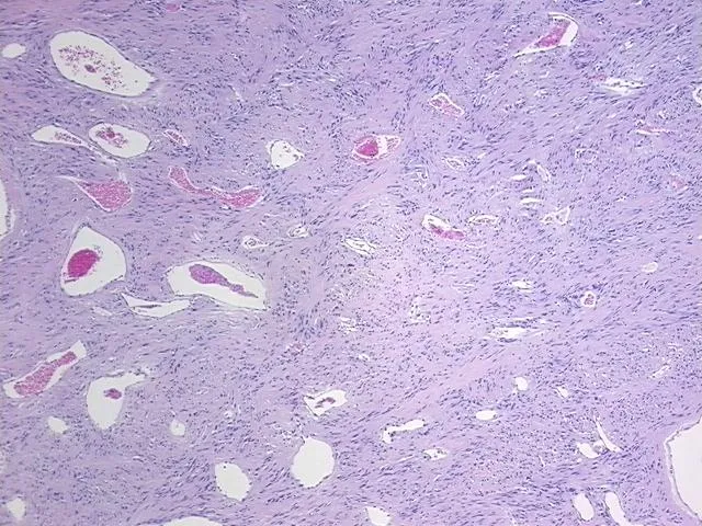 Tissue FFPE Sections, Duodenum - image 1