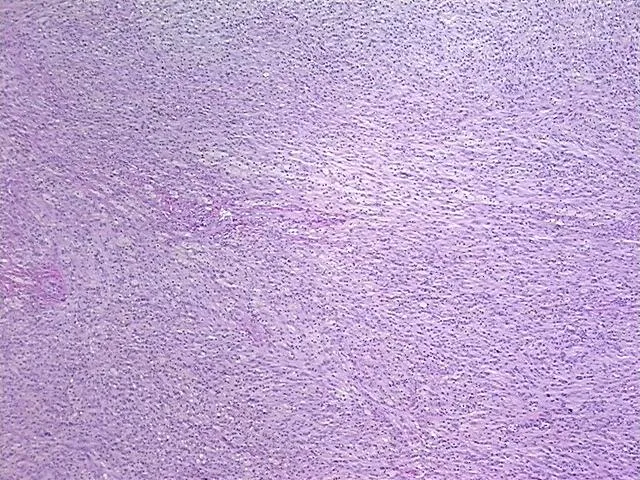 Tissue FFPE Sections, Soft tissue - image 1