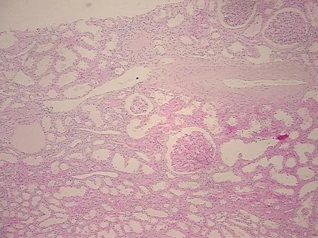 Tissue FFPE Sections, Kidney - image 1