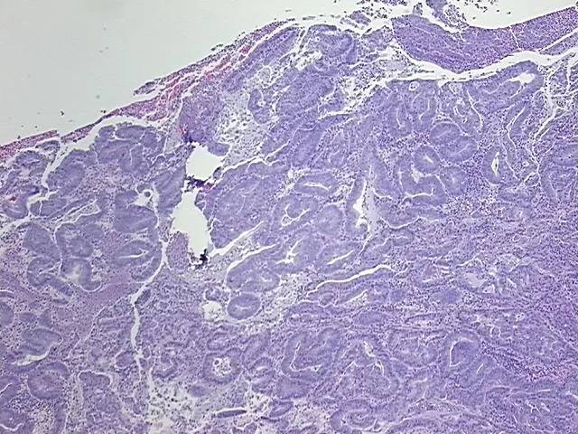 Tissue FFPE Sections, Endometrium - image 1