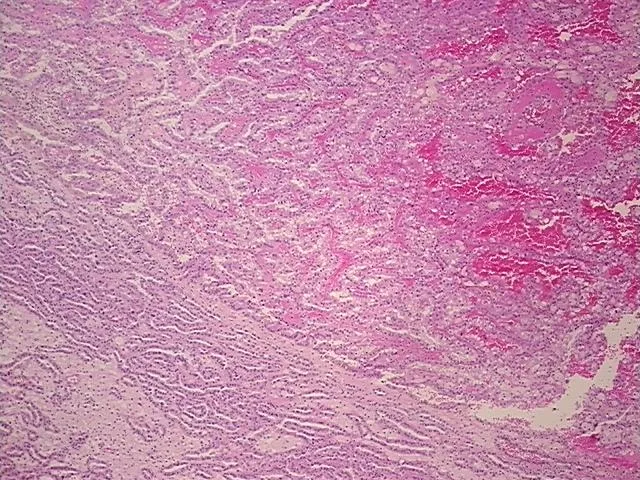 Tissue FFPE Sections, Kidney - image 1