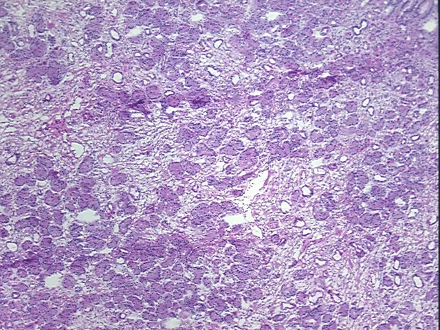 Tissue FFPE Sections, Lymphoid tissue - image 1