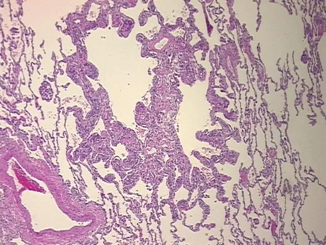 Tissue FFPE Sections, Lung - image 1