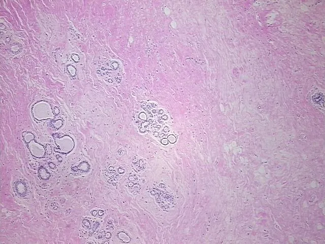 Tissue FFPE Sections, Breast - image 1