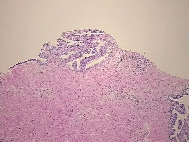 Tissue FFPE Sections, Prostate - image 1